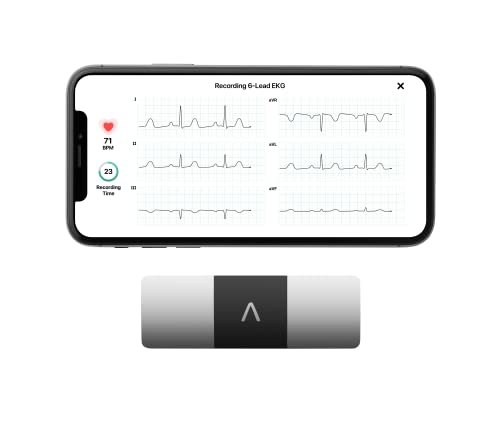 Best Fitbit for Cardiac Patients